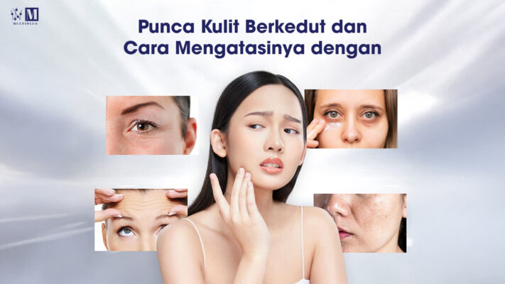Punca_Kulit_Berkedut